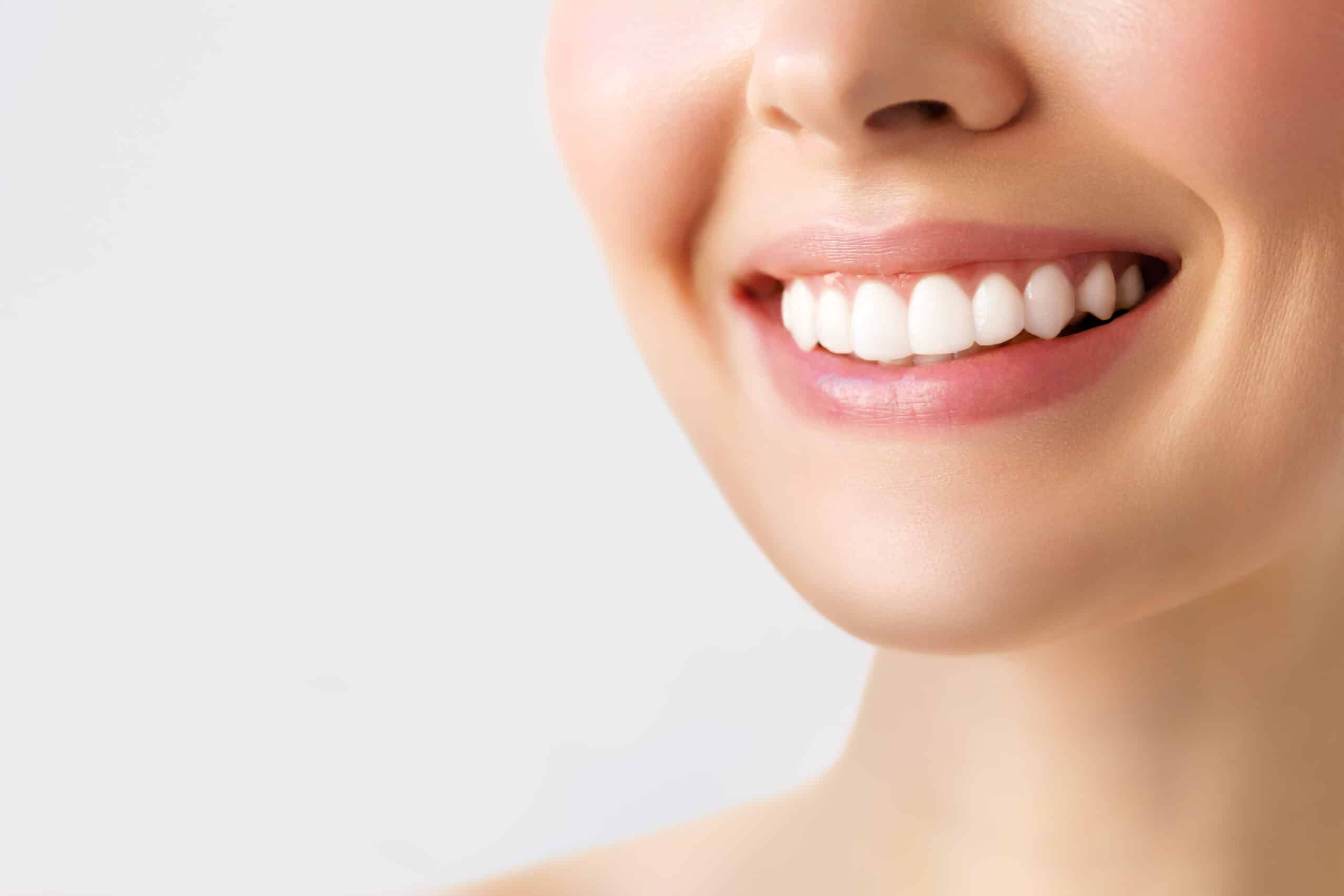 Teeth Whitening Mobile